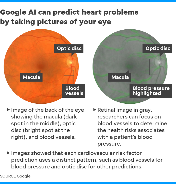 Google hopes AI can predict heart disease by looking at retinas
