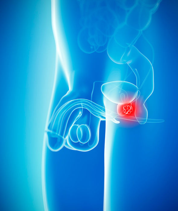 Prostate cancer symptoms: Do you have the signs? How to check and when to get the test