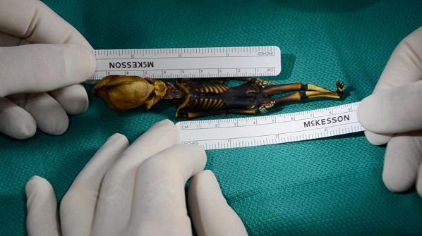 Mysterious tiny skeleton found in Chile was human girl with rare genetic mutations, scientists say