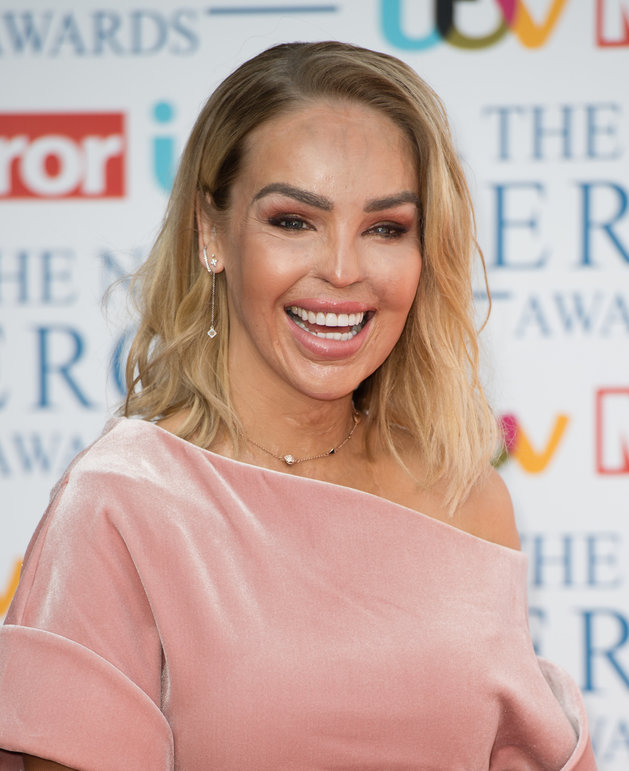 ‘Strictly Come Dancing’: Katie Piper Announced As First Celeb Taking Part In 2018 Series