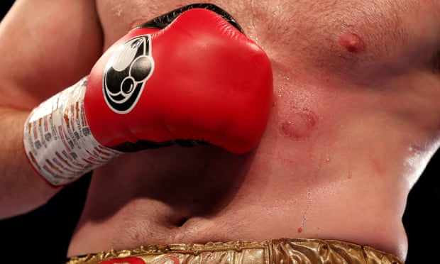 Kash Ali disqualified for biting David Price in bizarre heavyweight bout
