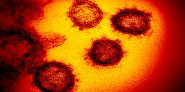 Coronavirus pandemic may have started in October, says UK-French study